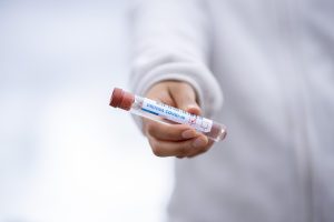 masca de par cu ou pentru caderea parului